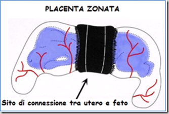 placenta zonata