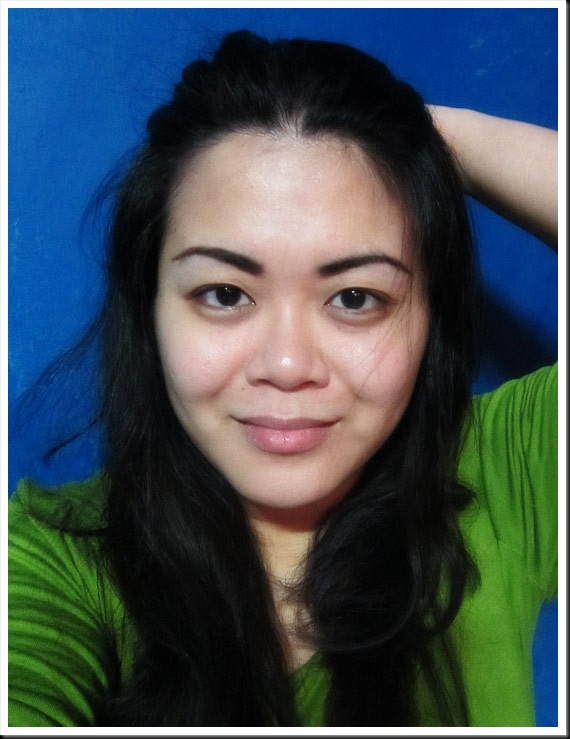 My eyebags