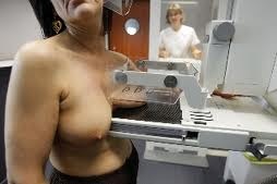 [mamografia-fotografia%255B3%255D.jpg]