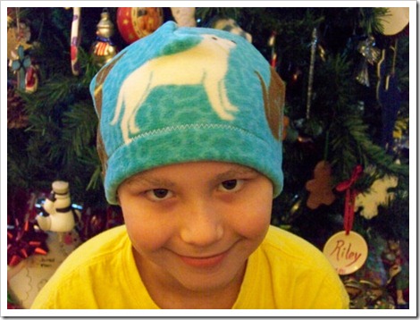 Beanies for Baldies