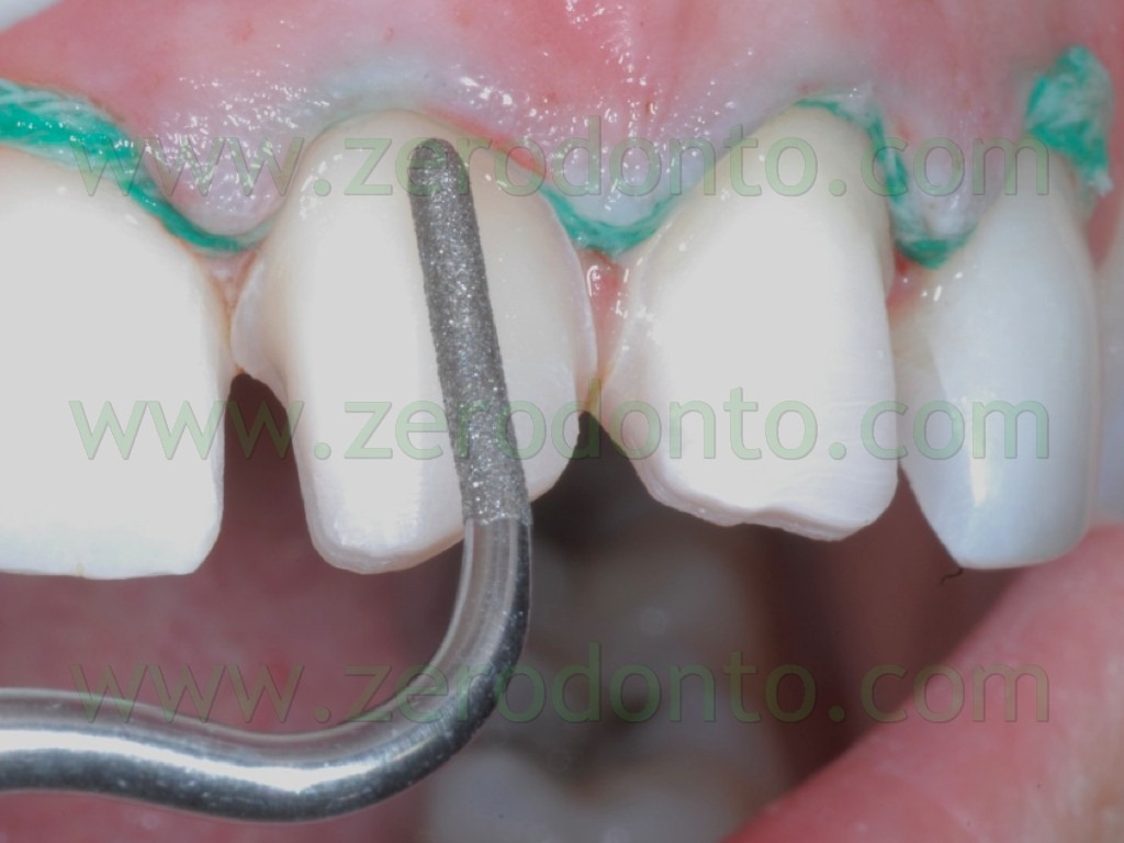 [60-preparazione-linea-finitura-cervi%255B2%255D.jpg]
