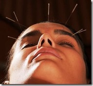 acupuntura curitiba estresse