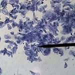 cell_cheek_02_100x.jpg