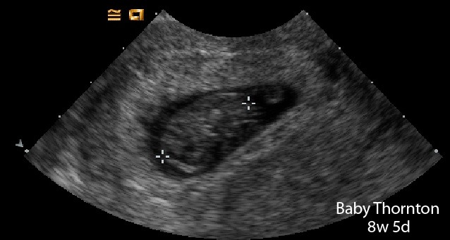 [BabyThornton1stPic%255B4%255D.jpg]