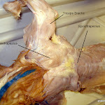 spinotrapezius_L.JPG