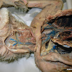 facial_veins.JPG