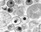 clamidia-microscopio-02.jpg
