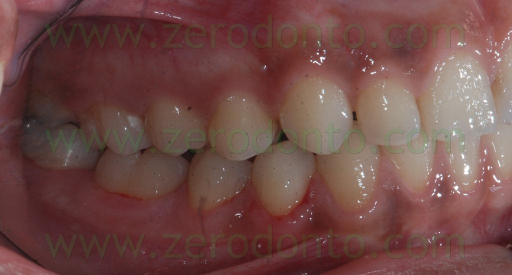 [38%2520prima%2520classe%2520dentaria%255B2%255D.jpg]
