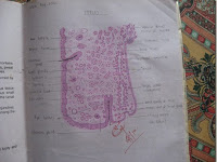 Eyelid Diagram Eyelid Diagram