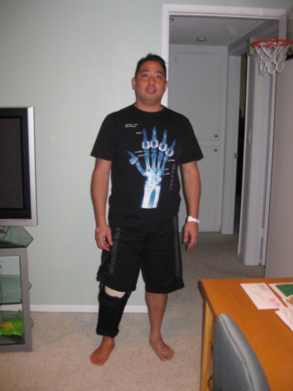 [acl_surgery_kerlan_jobe%255B3%255D.jpg]