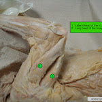 triceps_brachii_L.jpg