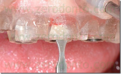 blog.075 blog.075