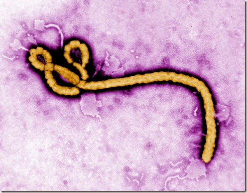 sintomas_ebola