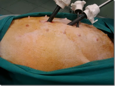 gastropessi preventiva 3 gastropessi preventiva 3