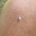Woolly Aphid