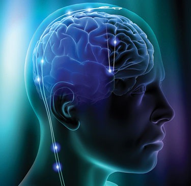 Brain-stimulation2 Brain-stimulation2