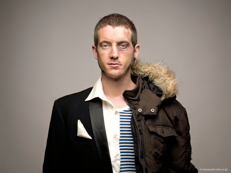 До и после употребления наркотиков (10 фото) | Картинка №4