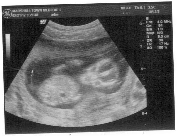 [03-18-2012%252012_54_41PM%255B3%255D.jpg]