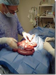 bowel bowel