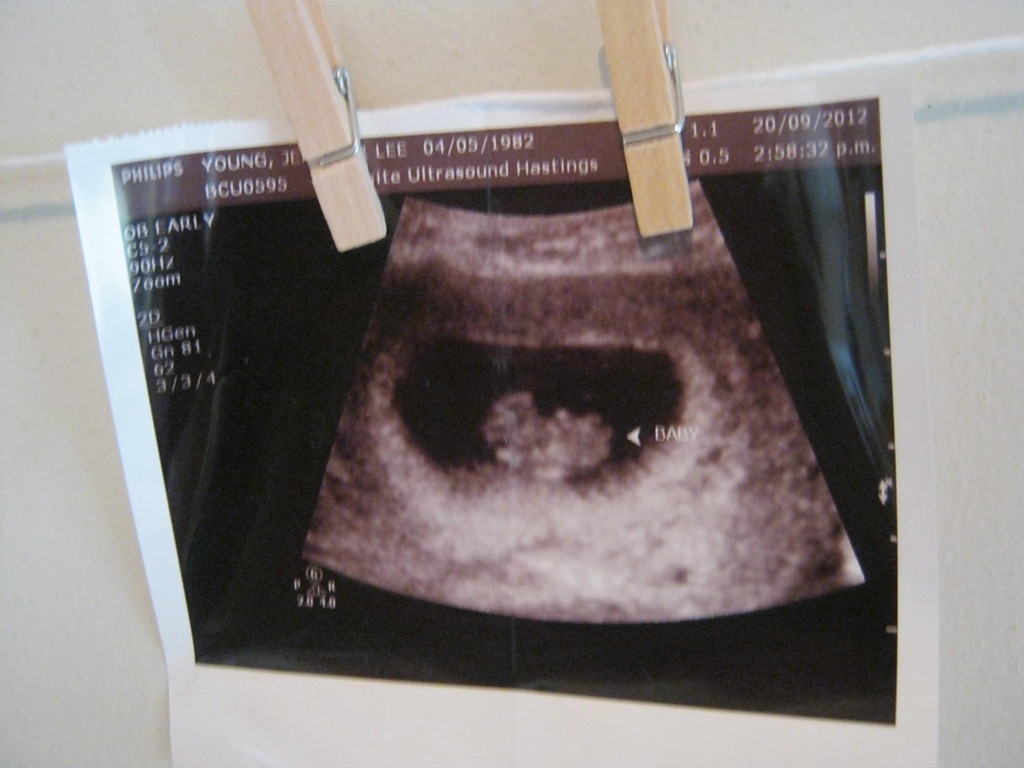 [IMG_6342%255B5%255D.jpg]