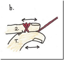 b knot