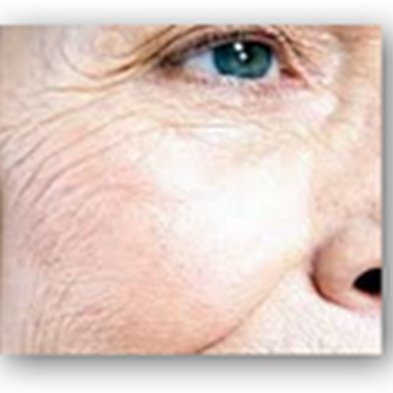 Stem Cell Trial to Begin in 12 Months For New Process to Reduce or End Wrinkles–Using Blood Cells Instead of Fat Cells