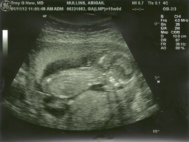 [baby%2520boy%252010005%255B3%255D.jpg]