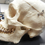 skull_mandible.jpg