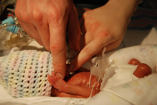 Dylan Brown, whose birth weight was 1 lb, 3 oz, was in the NICU for approximately four months. His parents got to hold him for the first time nine weeks after he was born. (Photo provided by Tracey Brown)