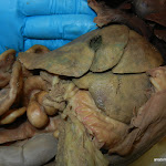 gall_bladder.JPG