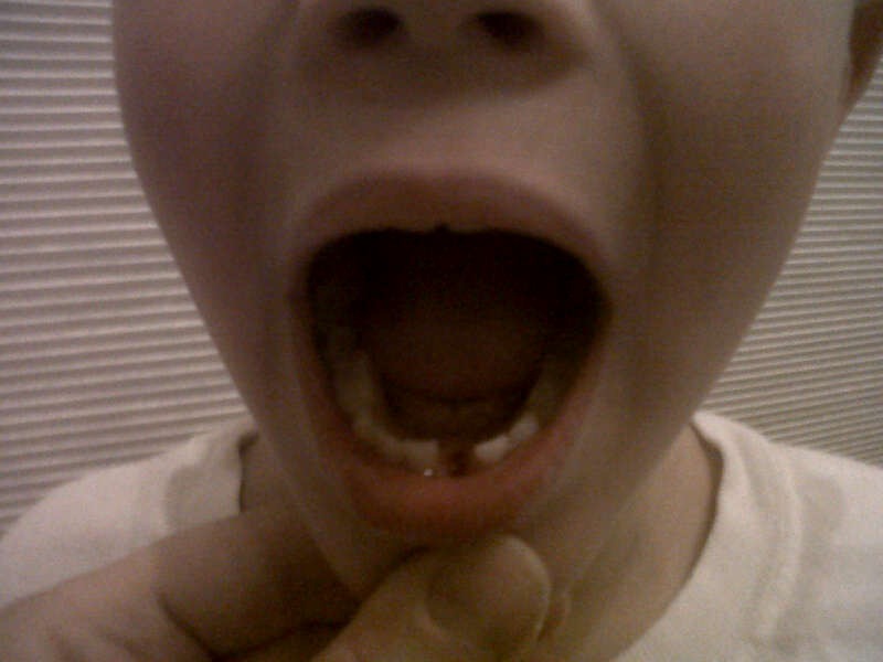 [IMG-20120229-WA0023%255B2%255D.jpg]