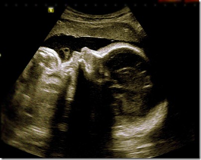 31 weeks (2)TFblog