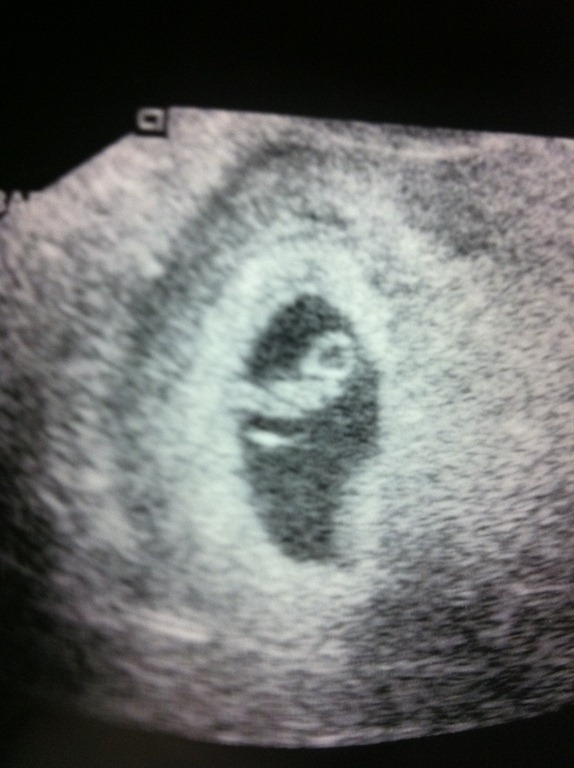 [1st-ultrasound4.jpg]