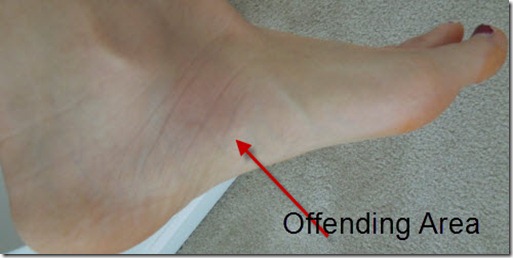 footpain