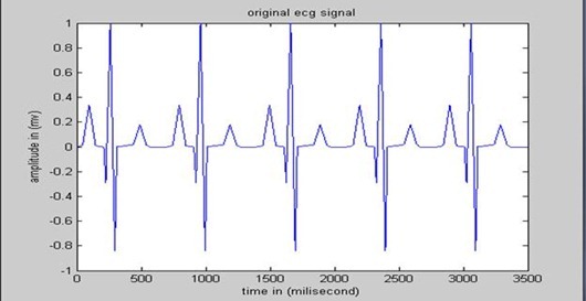 After removing noise from ECG signal After removing noise from ECG signal