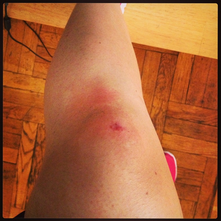 [knee%255B4%255D.jpg]