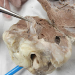 heart_valve.JPG