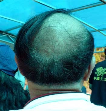 [comb_overs_29%255B2%255D.jpg]