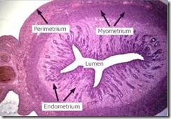 Uterus 1