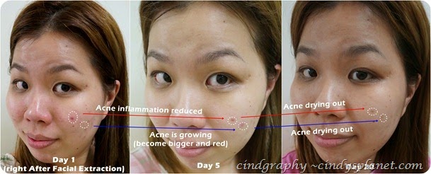 Cellnique Skin Action Sebum Gel review Cellnique Skin Action Sebum Gel review