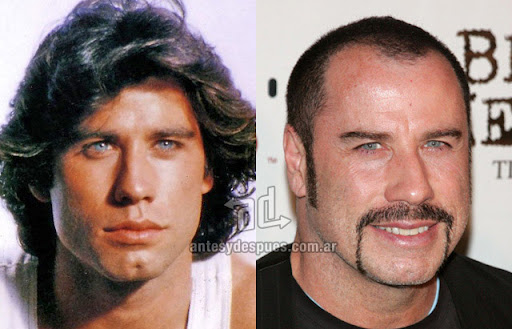 La caida del pelo de John Travolta