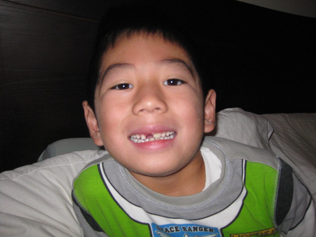 [missing_front_tooth%255B3%255D.jpg]