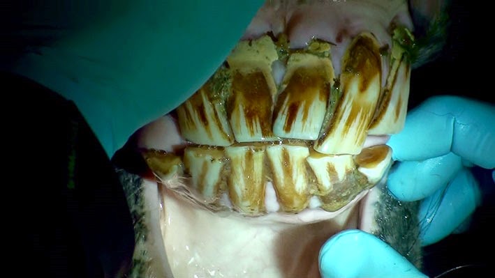 [20141114125348-%25282%2529%255B2%255D.jpg]