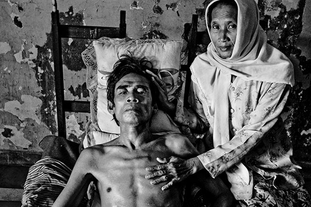 PHNOM PENH, CAMBODIA - DECEMBER 8:  A woman waits by her husbands side in the AIDS and TB ward of The Russian Hospital, Phnom Penh, Cambodia December 8, 2004.  Although he is suffering from carsenoma after 41 years of smoking, he is kept in the AIDS and TB ward which is where most impovrished patients end up.