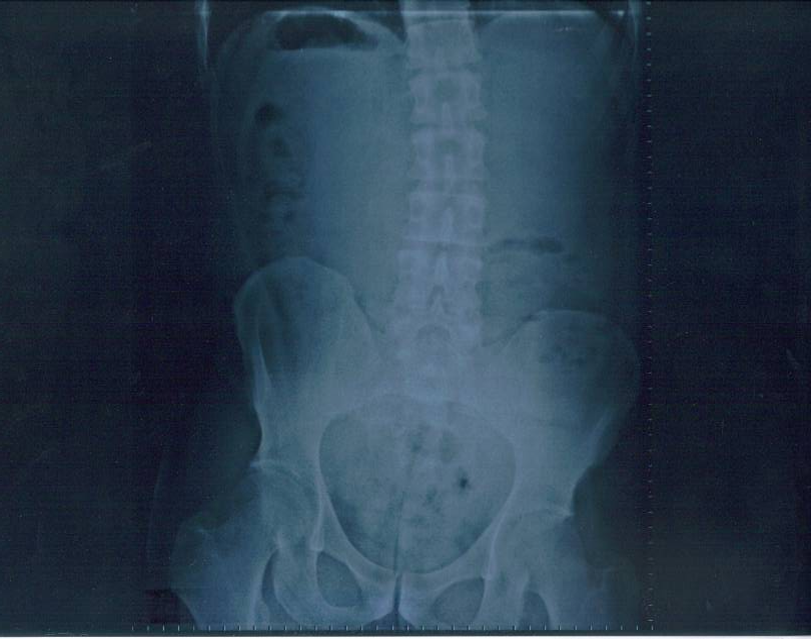 [Radiografia_caderas_JMM_2_N_20114.png]