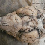 brain_dissect05.jpg brain_dissect05.jpg