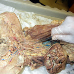 cat_ureter.JPG