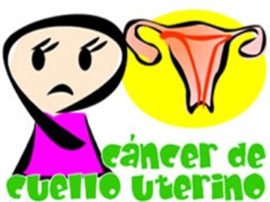 cancer cuello utero