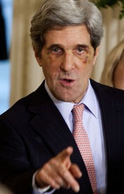 [JohnKerry-BlackEye-175x2754.jpg]