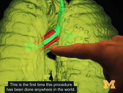 3DPrinter_Medical